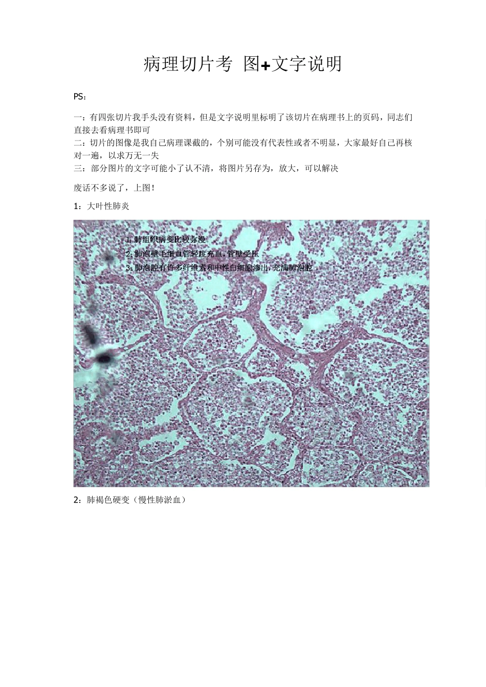 病理切片考图+文字说明_第1页