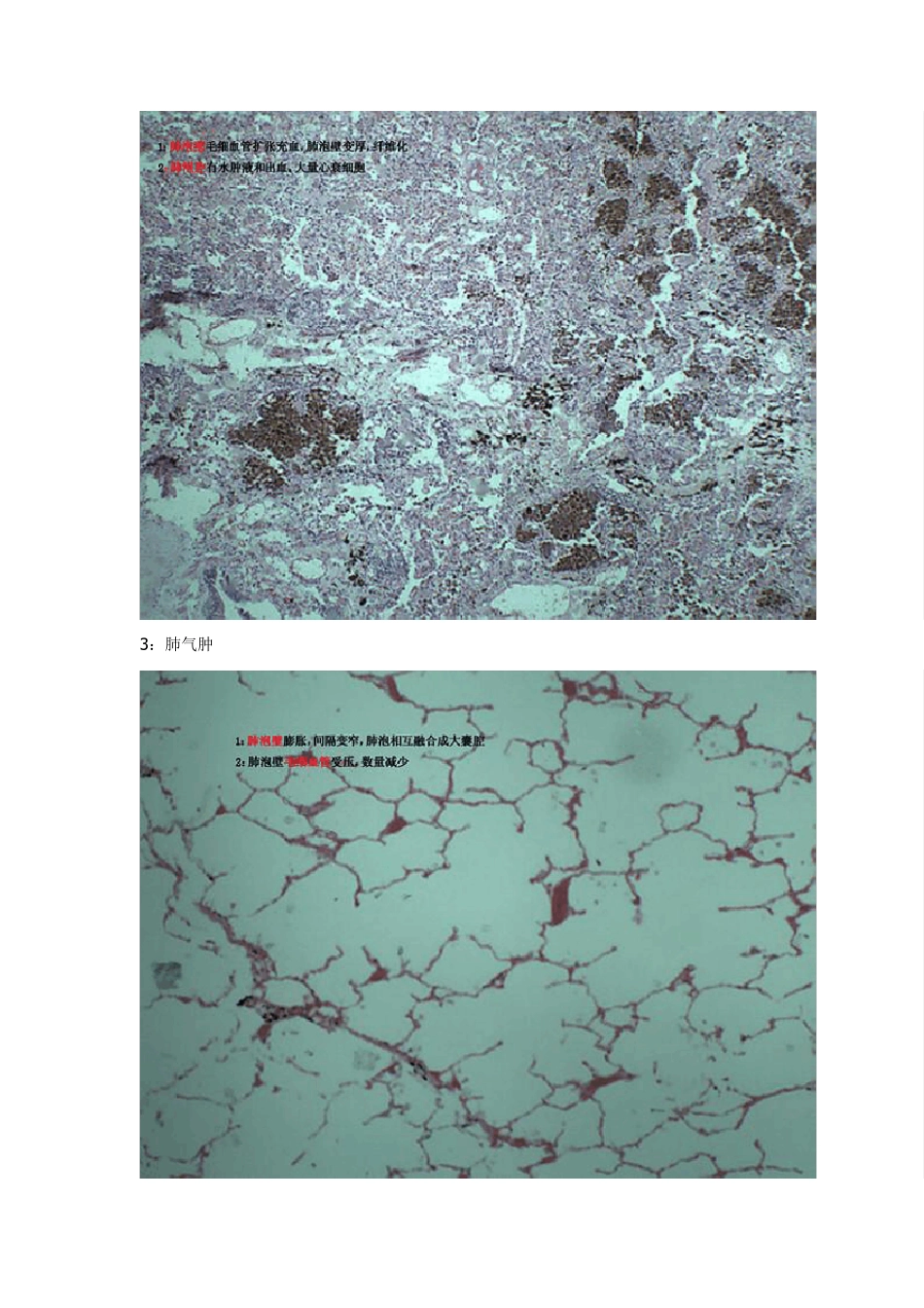 病理切片考图+文字说明_第2页