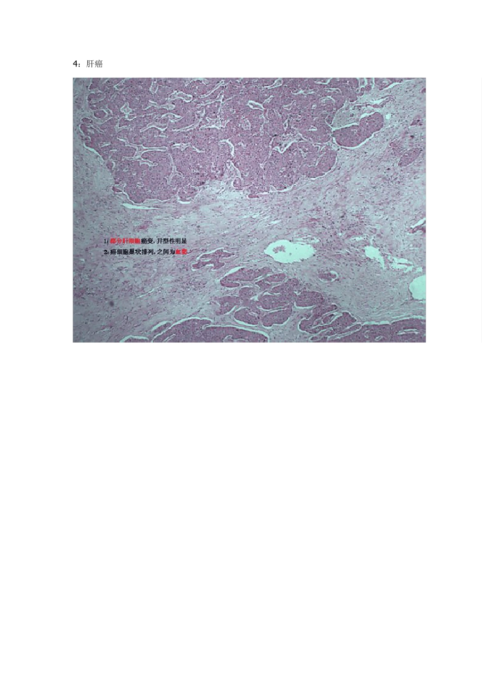 病理切片考图+文字说明_第3页