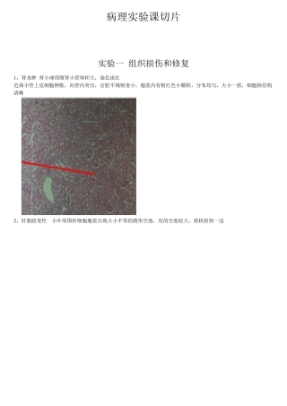 病理学切片和标本