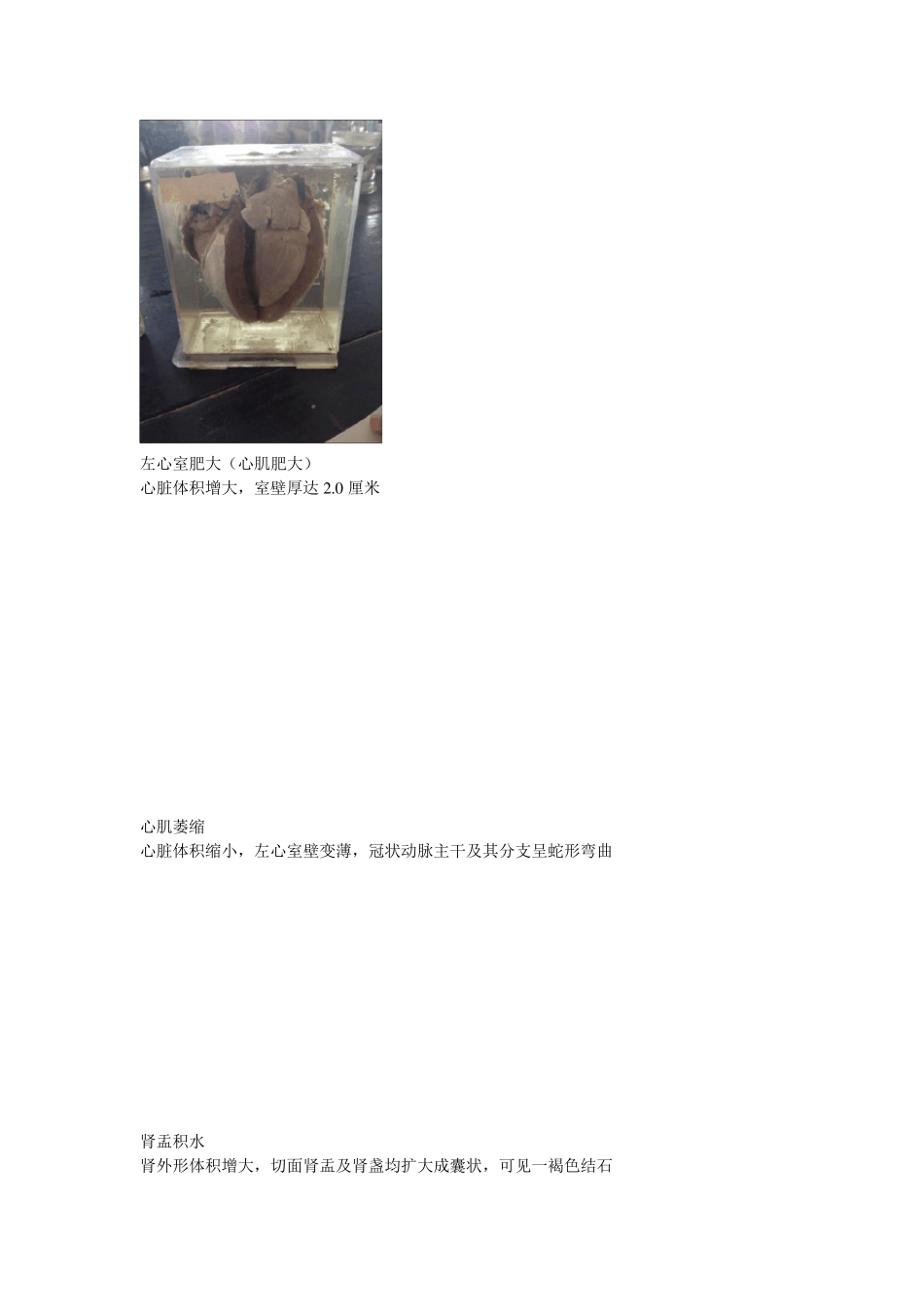 病理学实验大体标本图片和描述_第1页