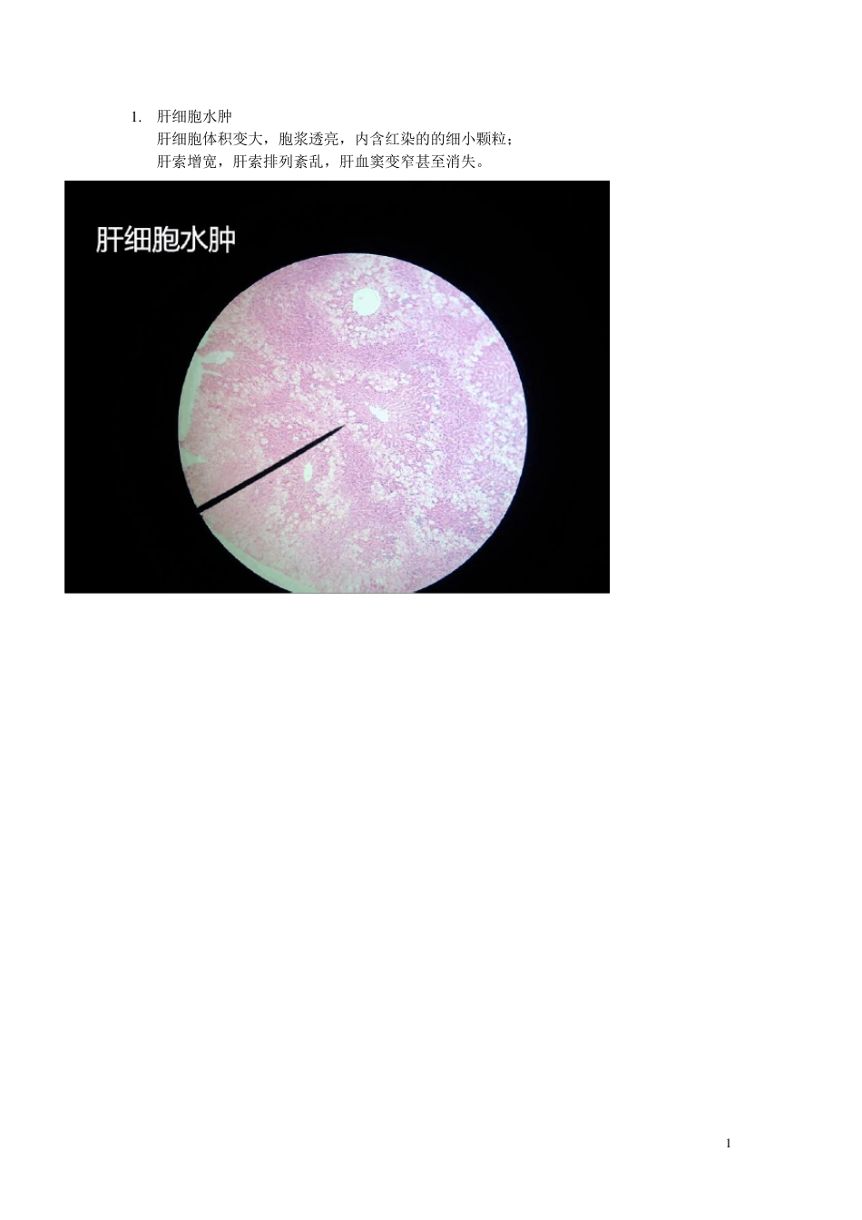 病理学镜下切片_第1页