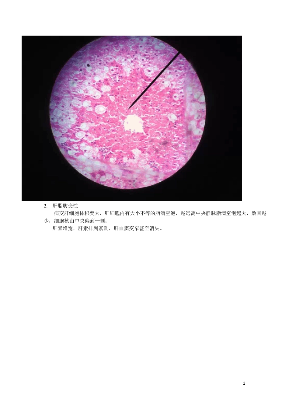 病理学镜下切片_第2页