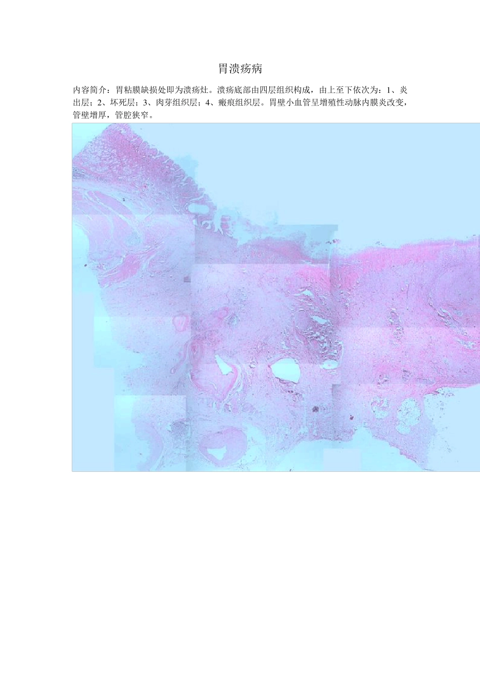 病理实验切片镜下观_第1页