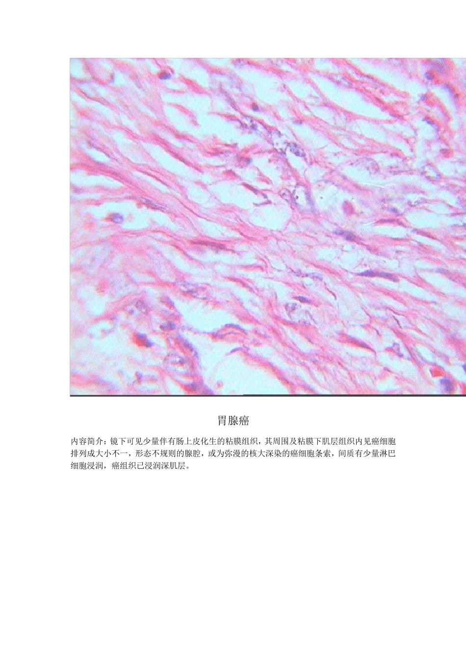 病理实验切片镜下观_第3页