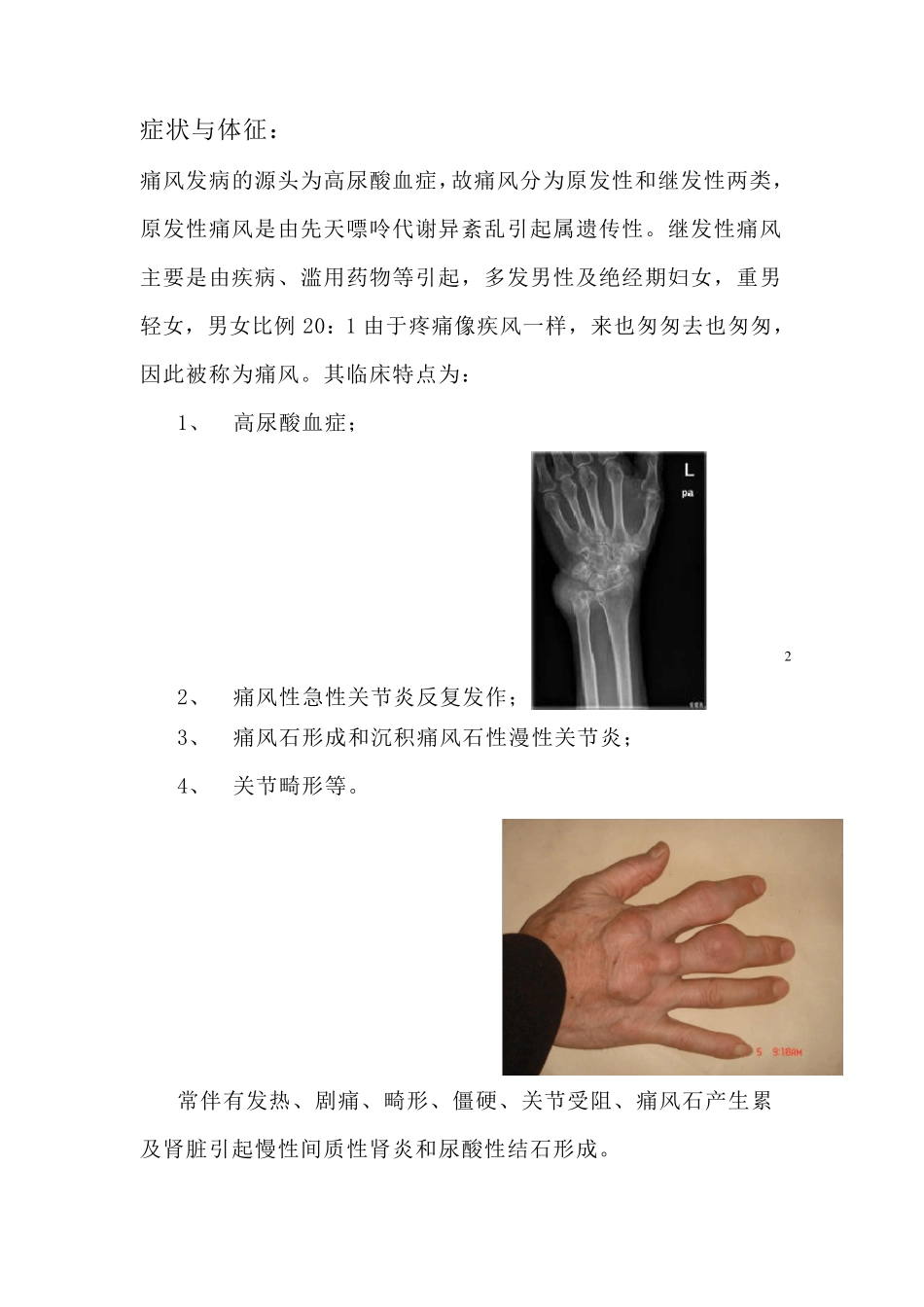 痛风健康教育_第2页