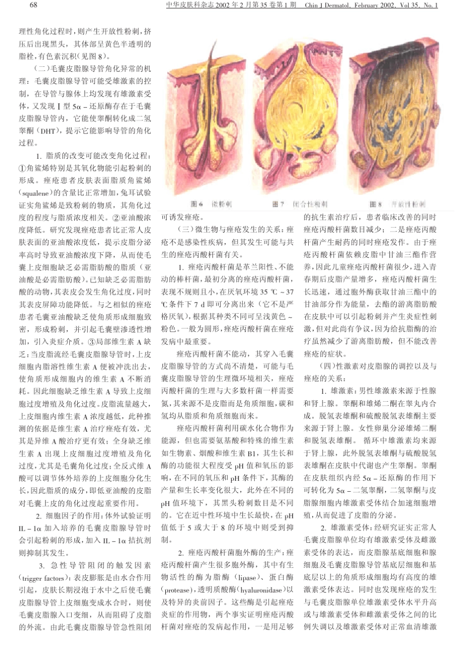 痤疮的分型论治_第2页