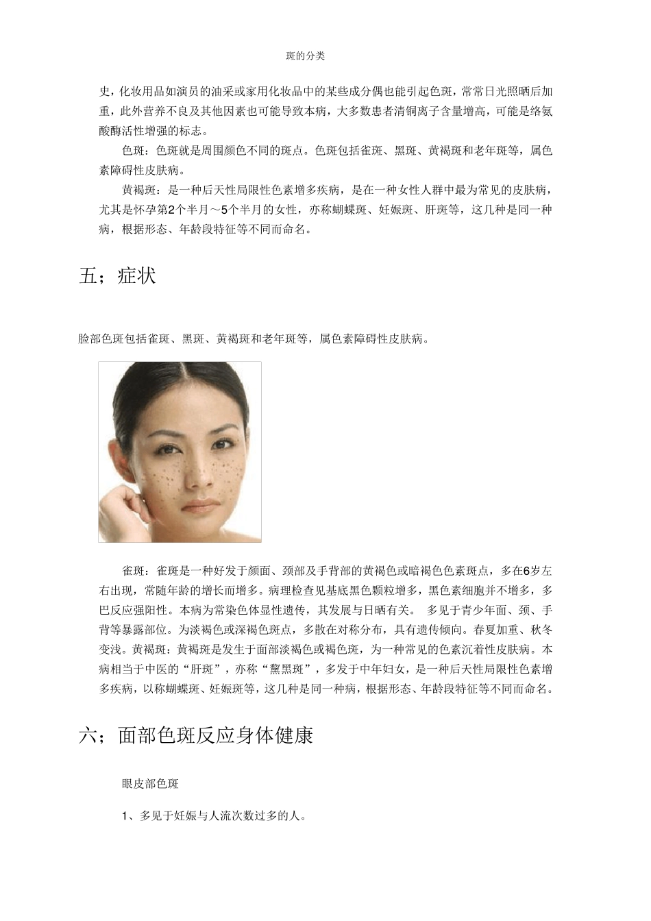 皮肤色斑分类_第3页