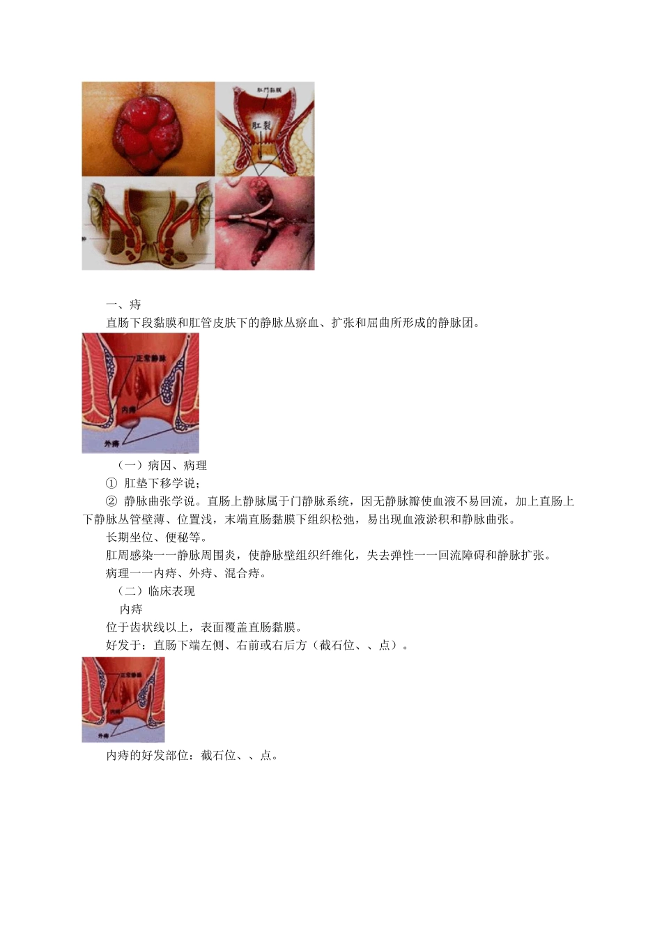 直肠肛管疾病病人的护理精华版_第3页