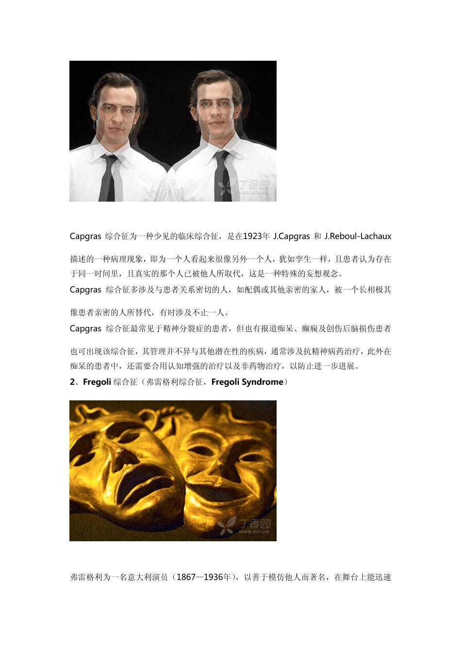 盘点精神科那些有趣但又少见的综合征_第2页