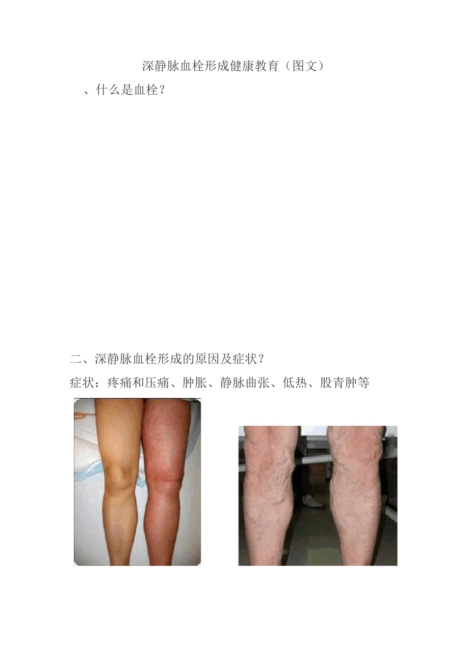 深静脉血栓形成健康教育(图文_第1页