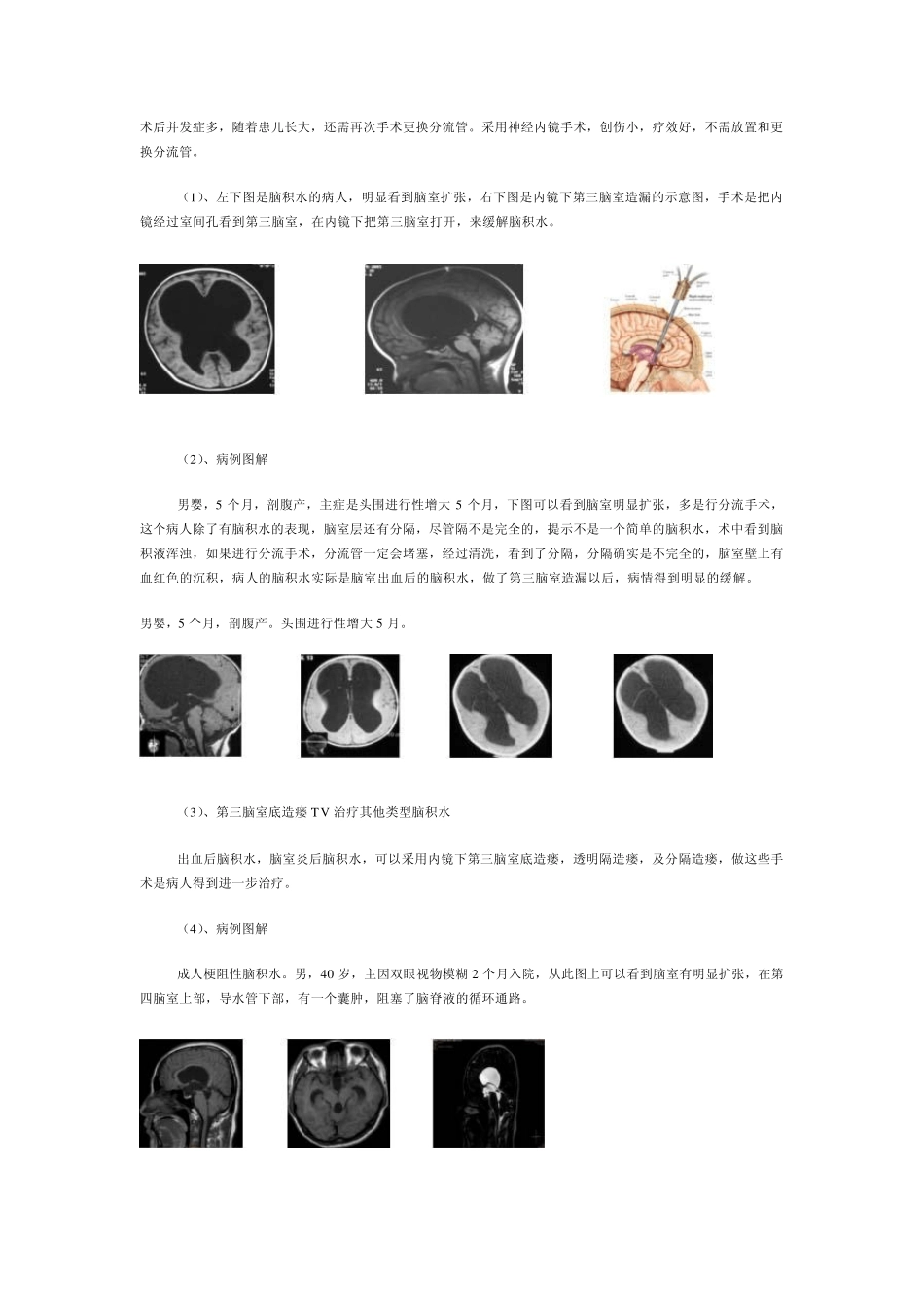 神经内镜技术进展_第2页