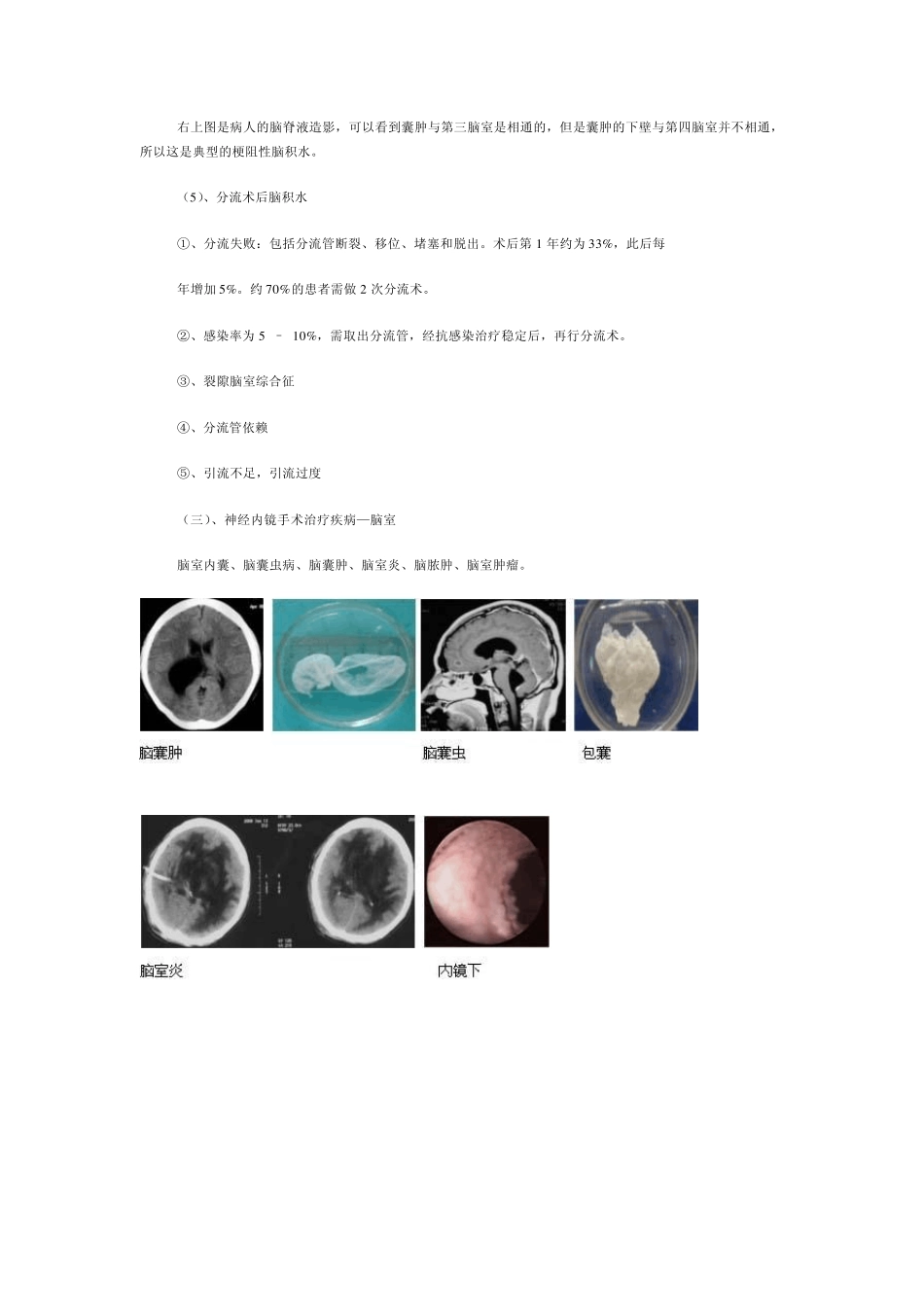 神经内镜技术进展_第3页