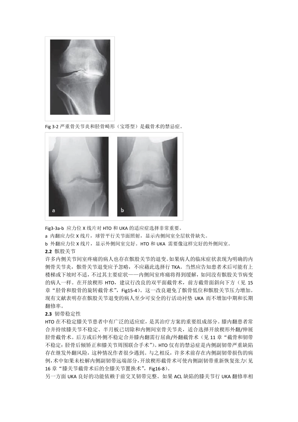 第3章胫骨高位截骨、膝关节单髁置换和全膝关节置换的适应症_第2页