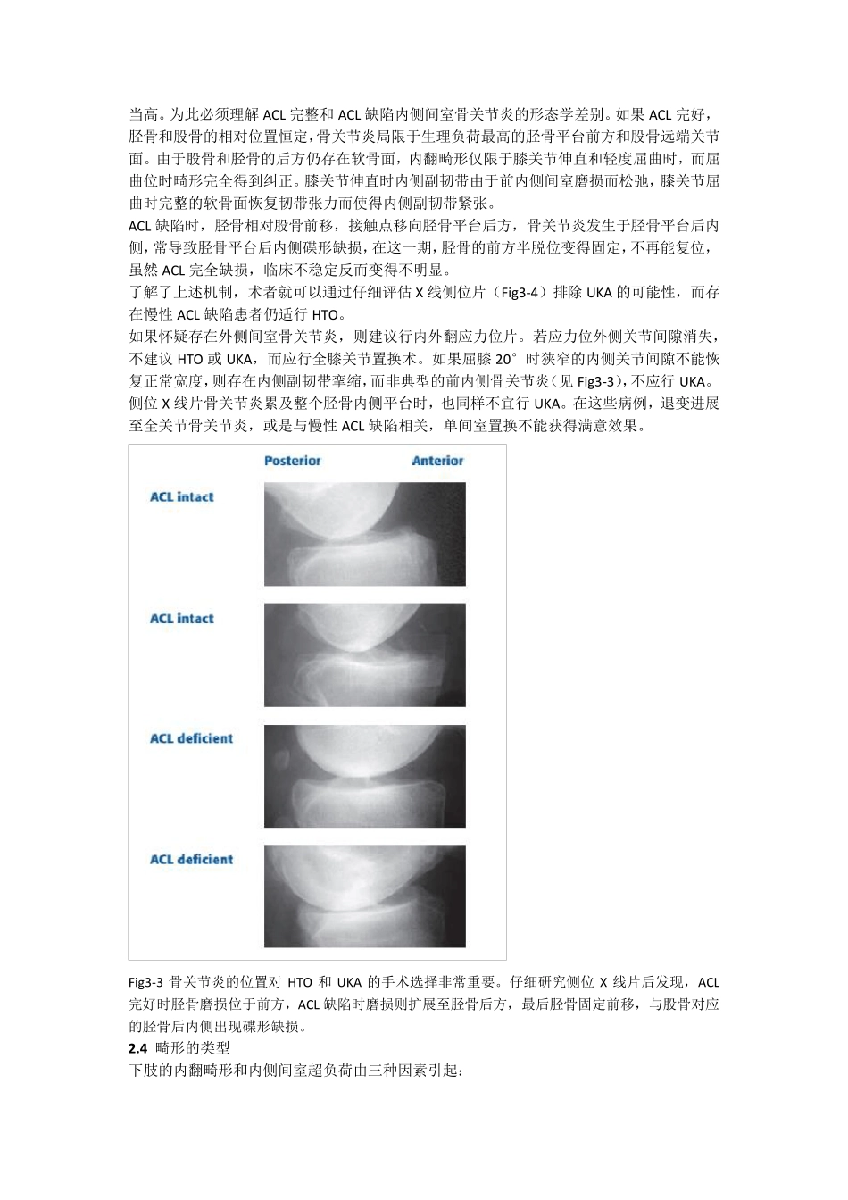 第3章胫骨高位截骨、膝关节单髁置换和全膝关节置换的适应症_第3页