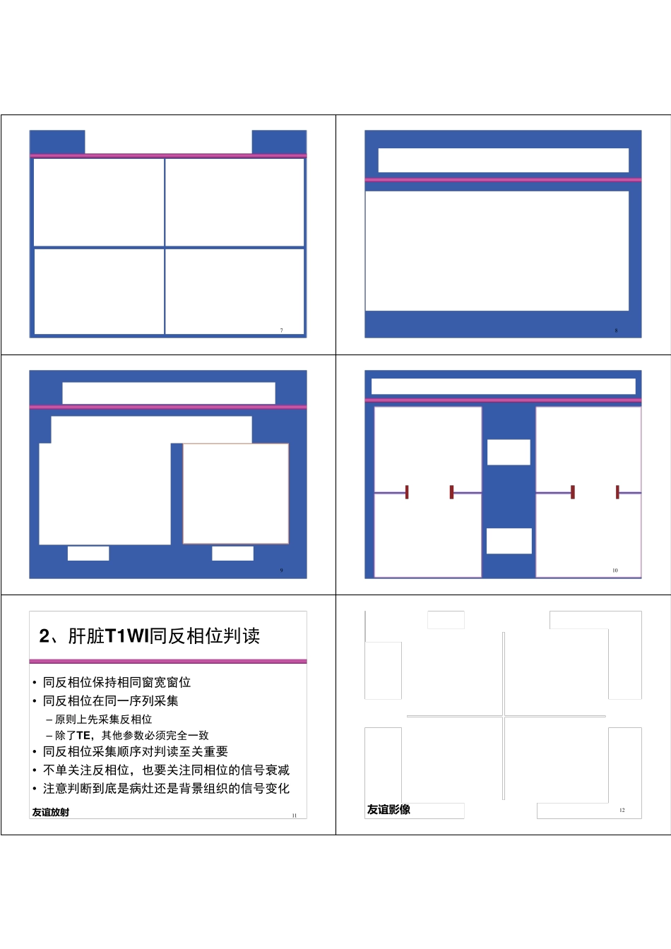 肝脏MRI图像正确判读及重要征象识别_第2页