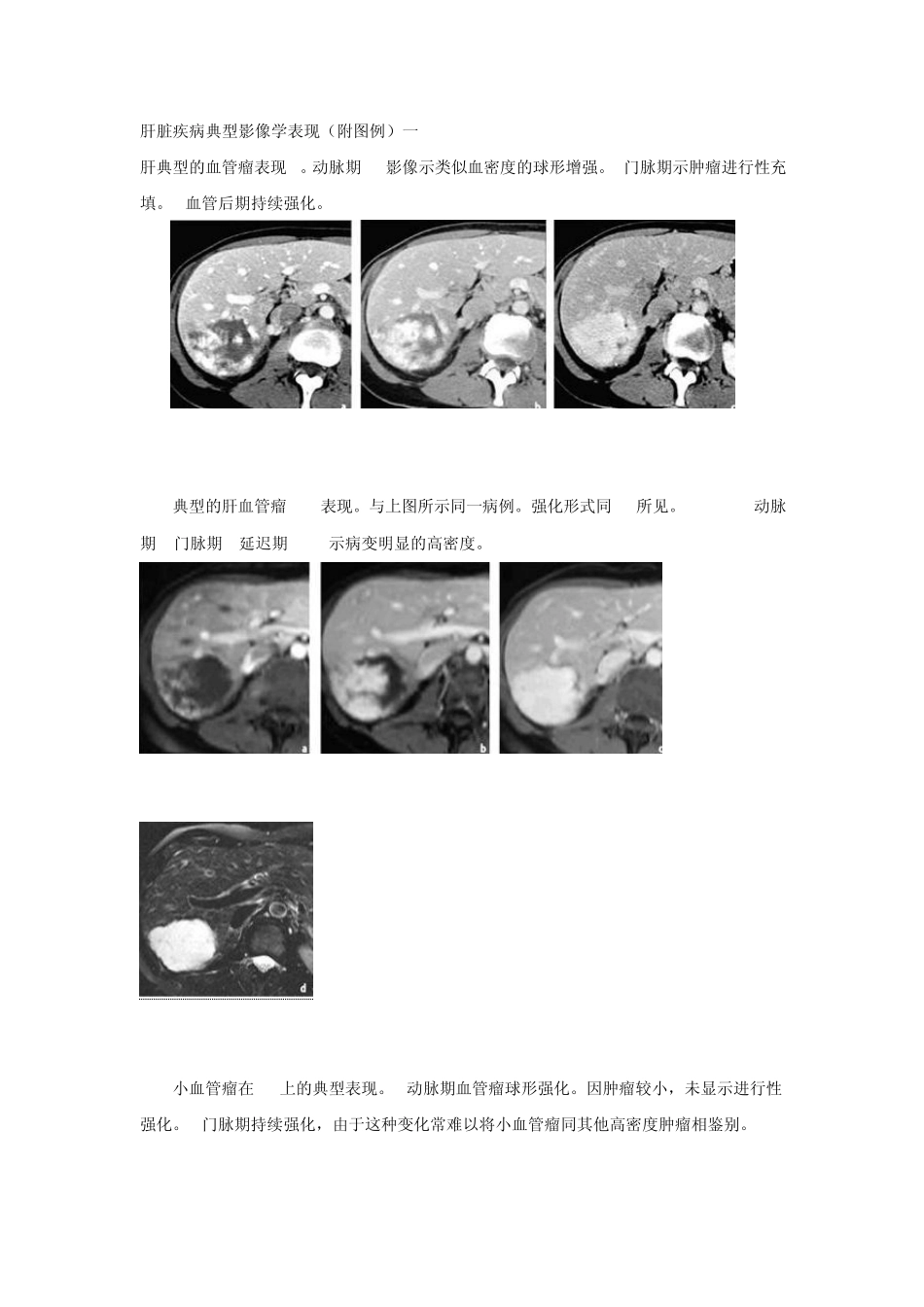 肝脏疾病典型影像学表现(附图例)_第1页