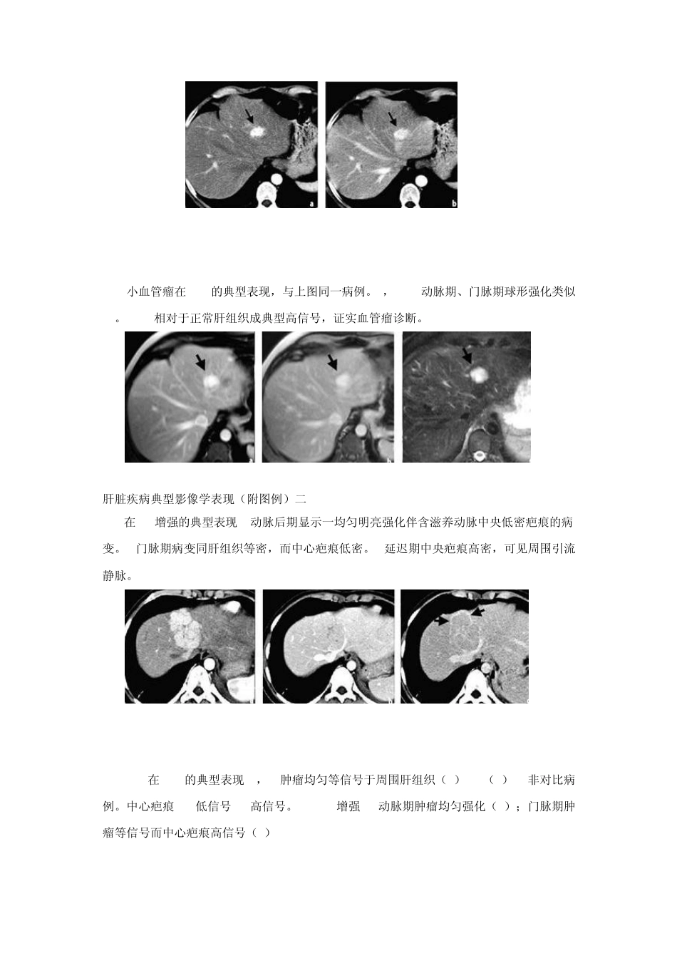 肝脏疾病典型影像学表现(附图例)_第2页