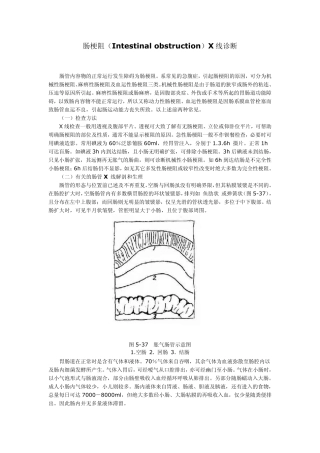 肠梗阻(Intestinalobstruction)X线诊断
