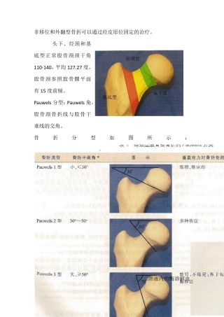 股骨颈骨折闭合或切开复位内固定术