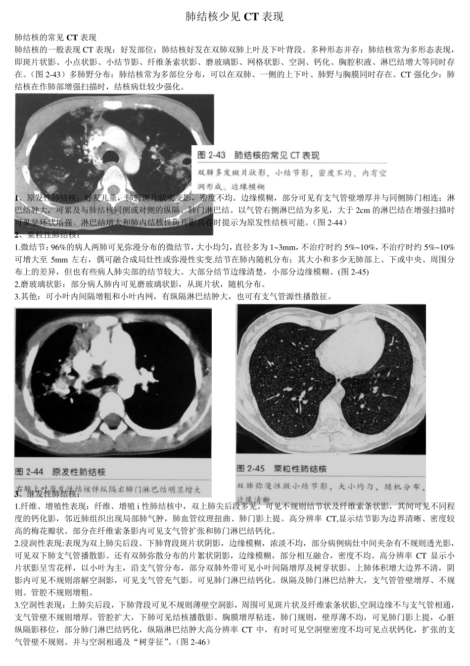 肺结核少见CT表现_第1页