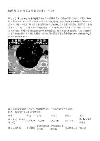 肺结节CT的征象及显示