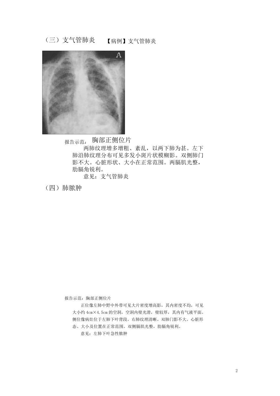 肺部诊断报告_第2页