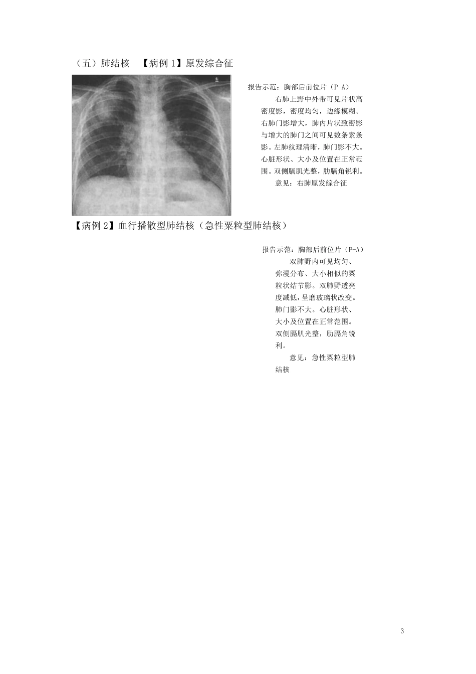 肺部诊断报告_第3页