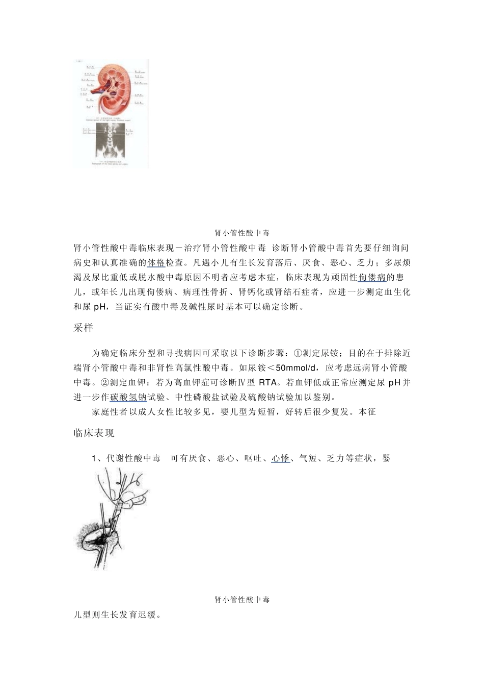 肾小管性酸中毒学习_第2页