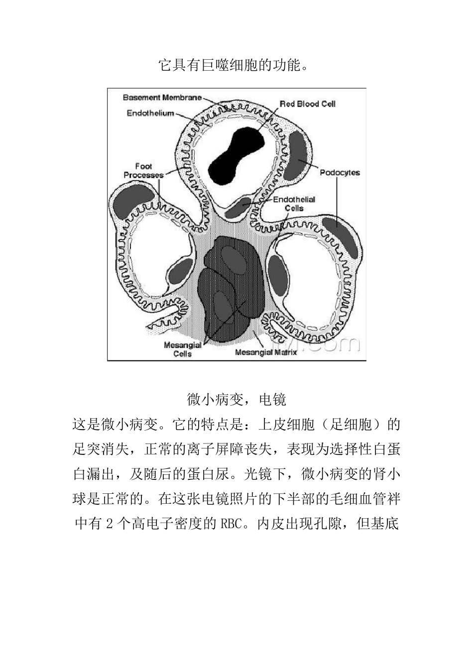肾脏病理图片(肾小球肾炎病理图片)_第3页