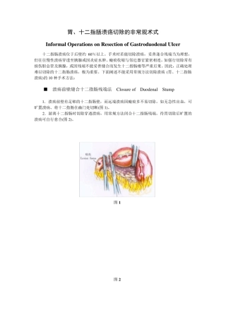 胃、十二指肠溃疡切除的非常规术式