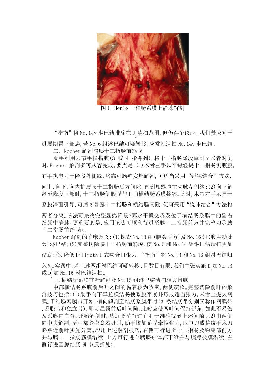 胃癌D2淋巴结清扫技术要点与实施_第2页