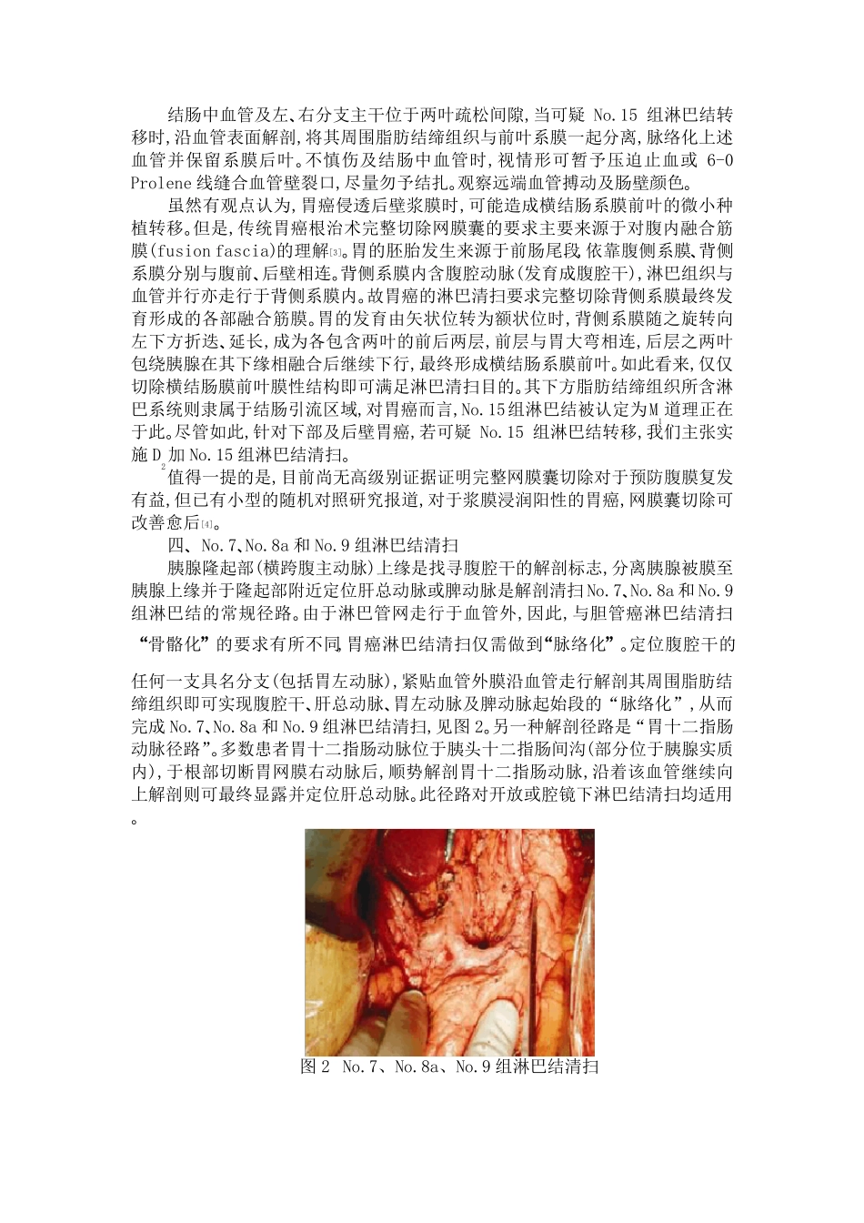 胃癌D2淋巴结清扫技术要点与实施_第3页