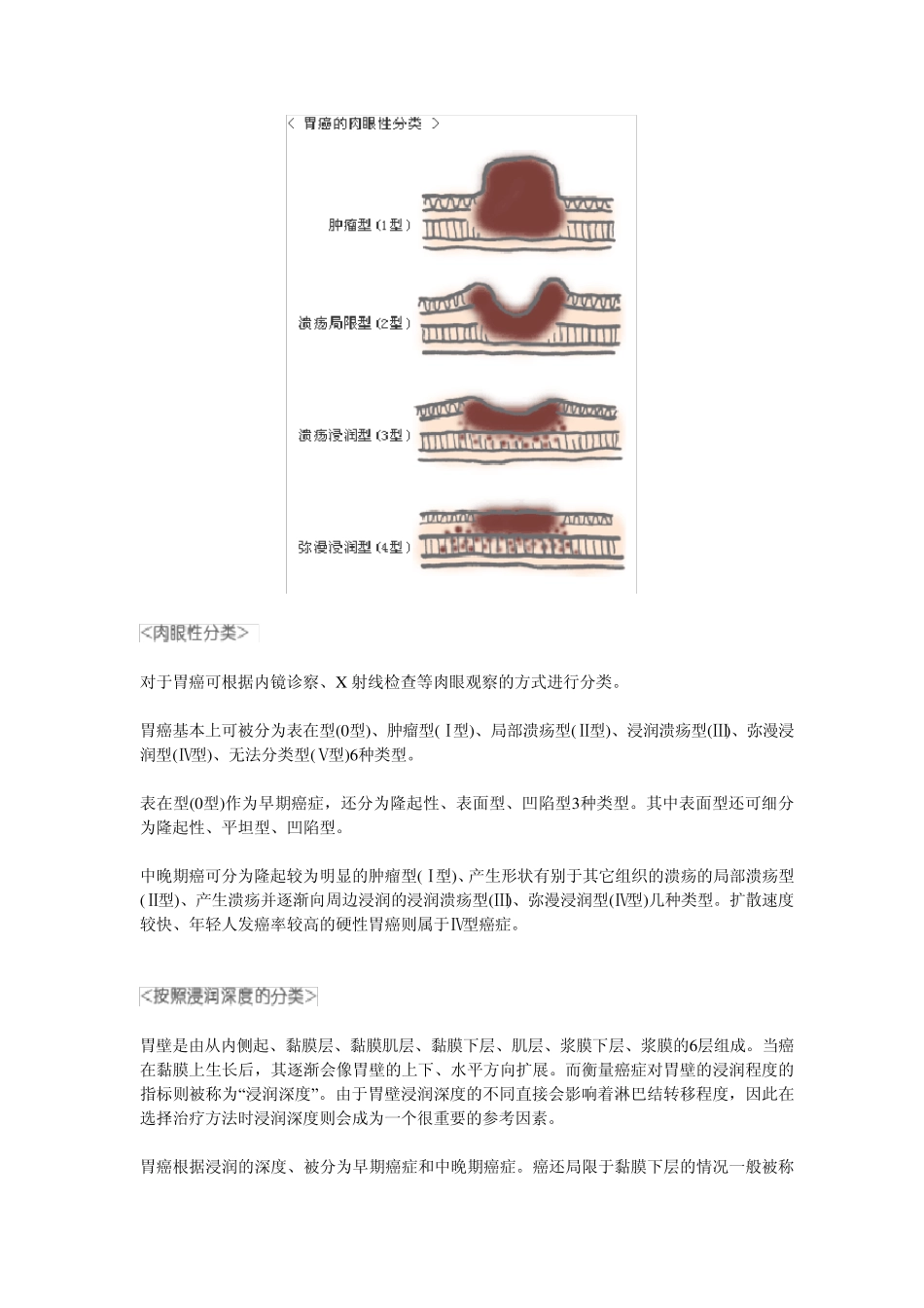 胃癌的症状介绍_第2页