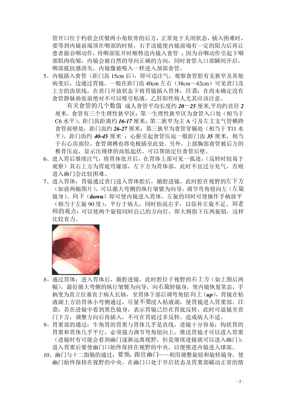 胃镜操作心得_第2页