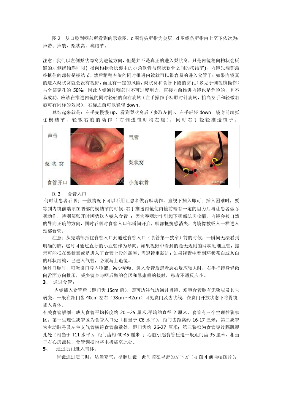 胃镜操作技术要领和经验_第2页