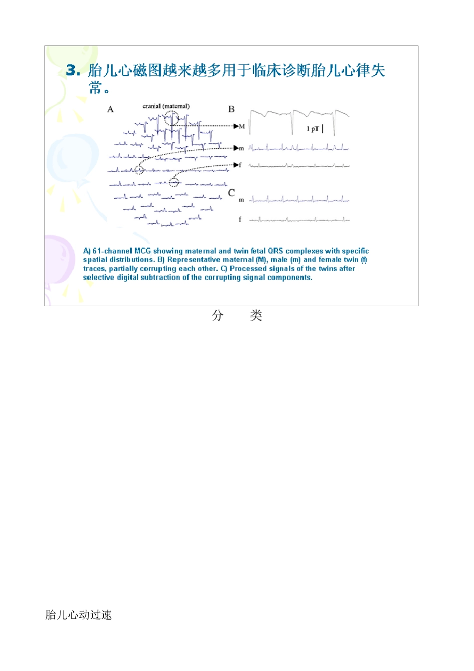 胎儿心律失常_第3页