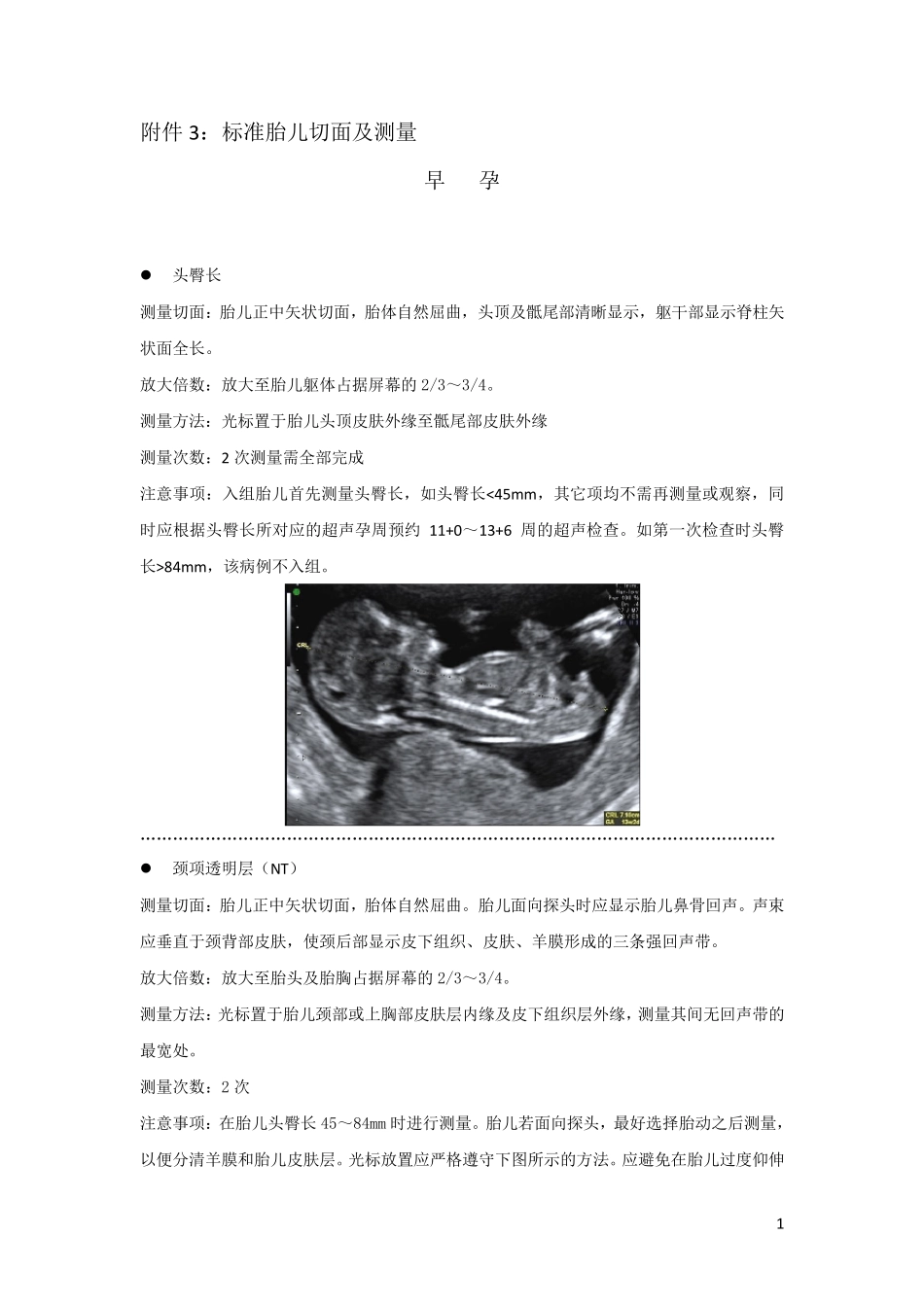 胎儿标准测量切面_第1页
