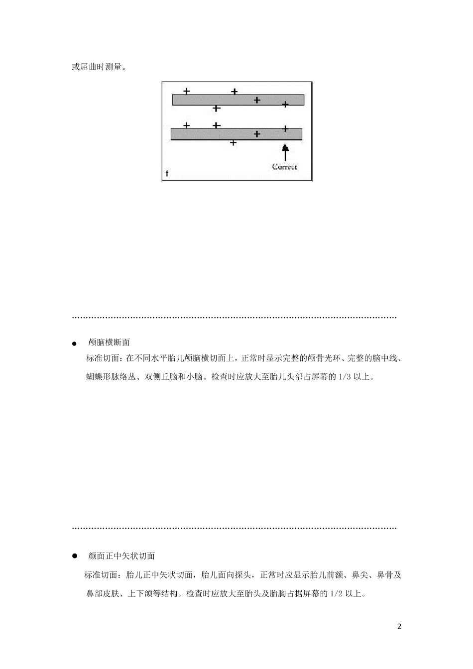 胎儿标准测量切面_第2页