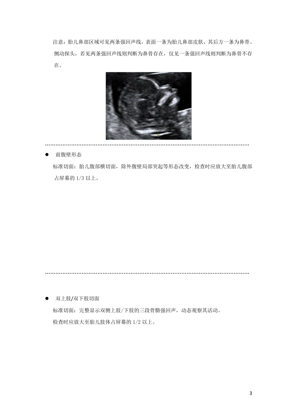 胎儿标准测量切面_第3页