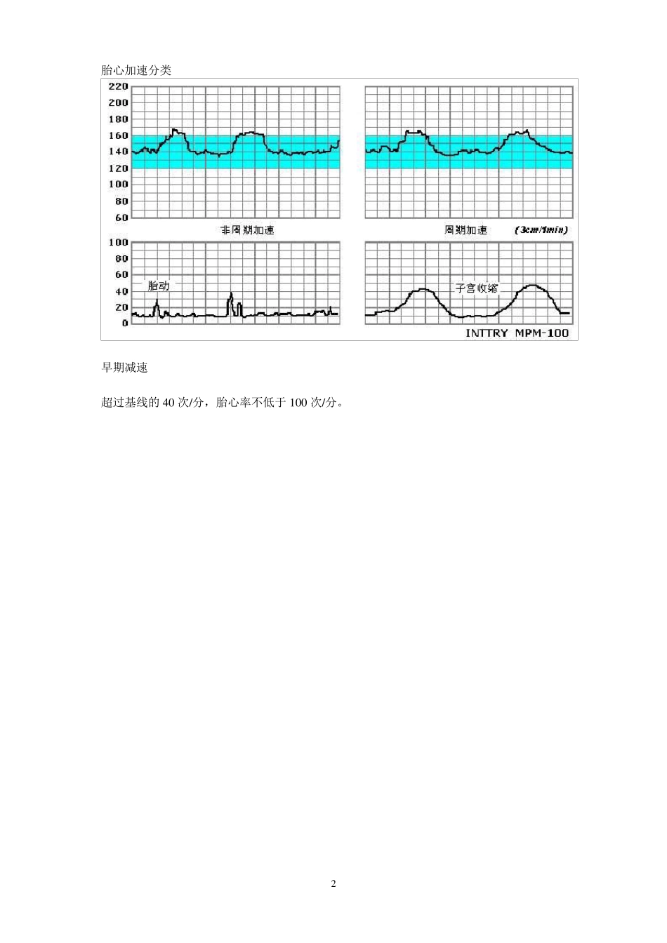 胎心监护图谱_第2页