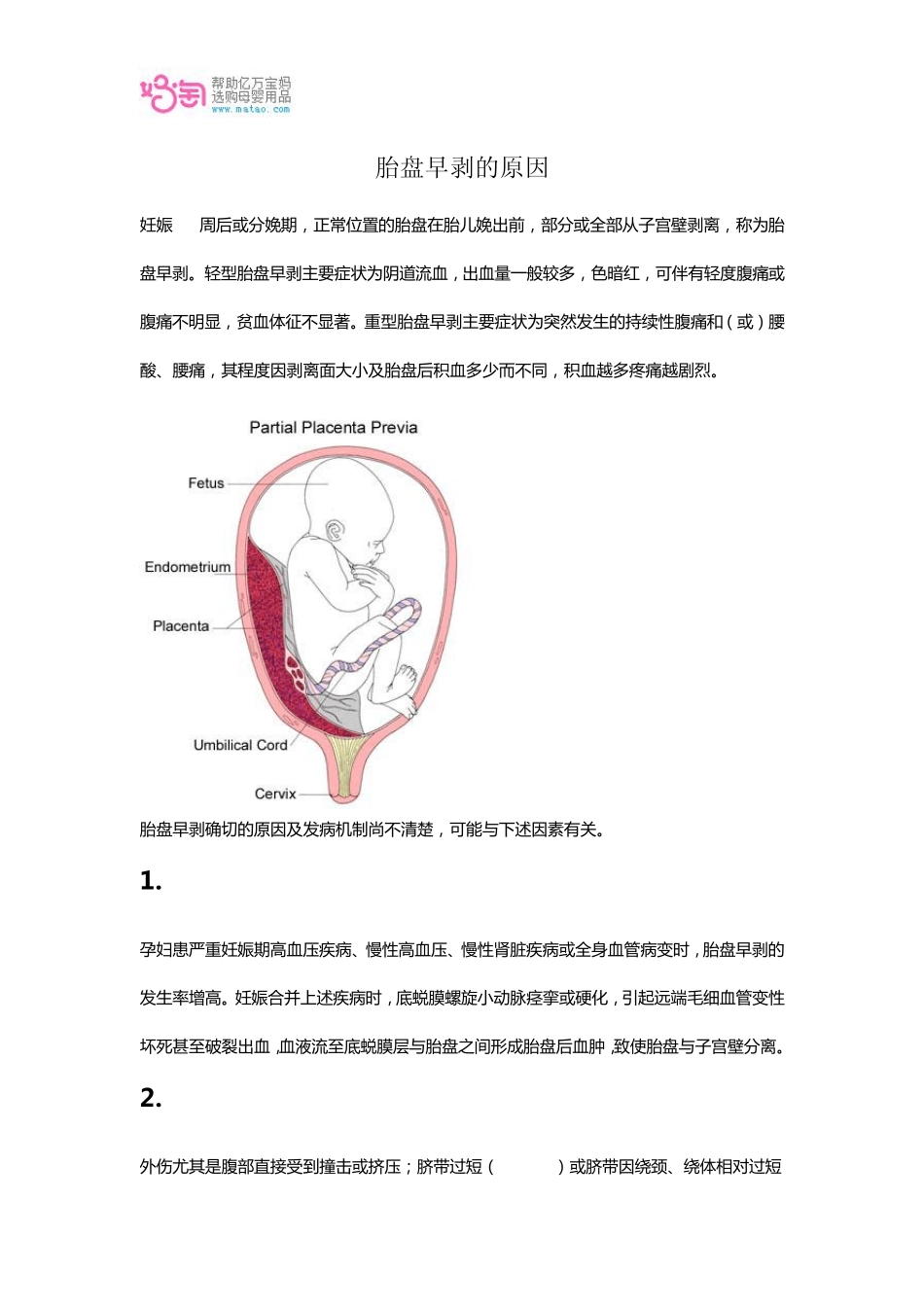 胎盘早剥的原因_第1页
