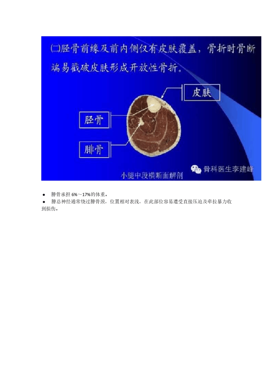 胫腓骨骨折的治疗方法_第3页