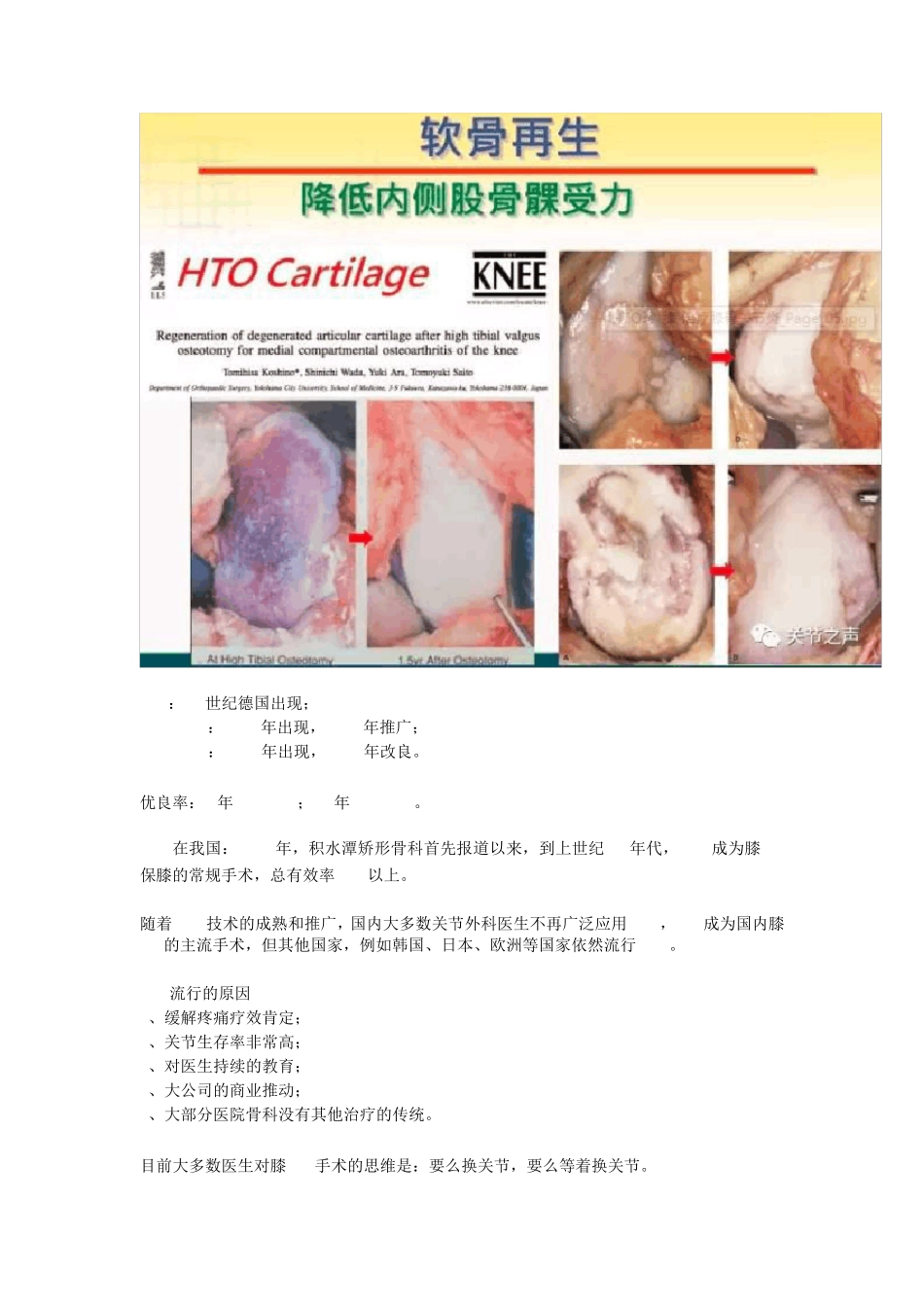 胫骨高位截骨术_第2页