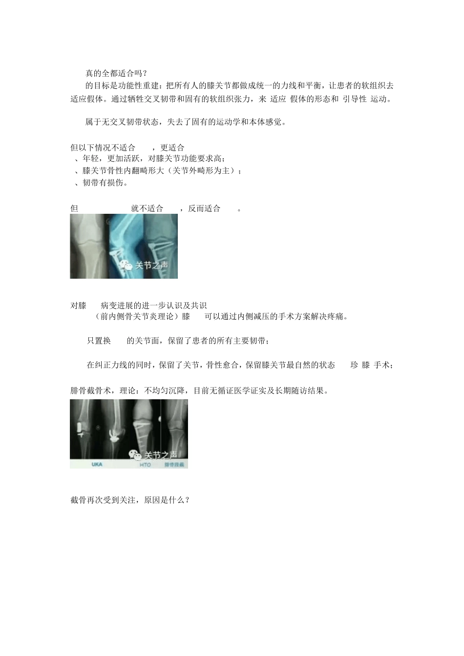 胫骨高位截骨术_第3页