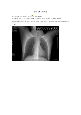 胸部CT三维重建