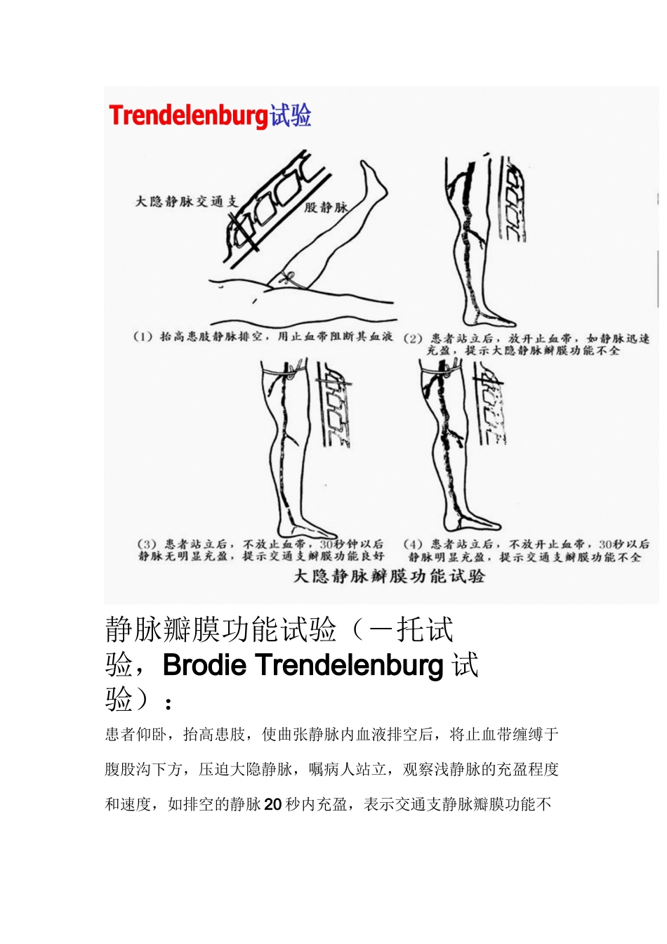 下肢静脉曲张三种检查方法_第3页