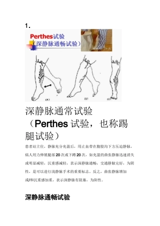 下肢静脉曲张三种检查方法