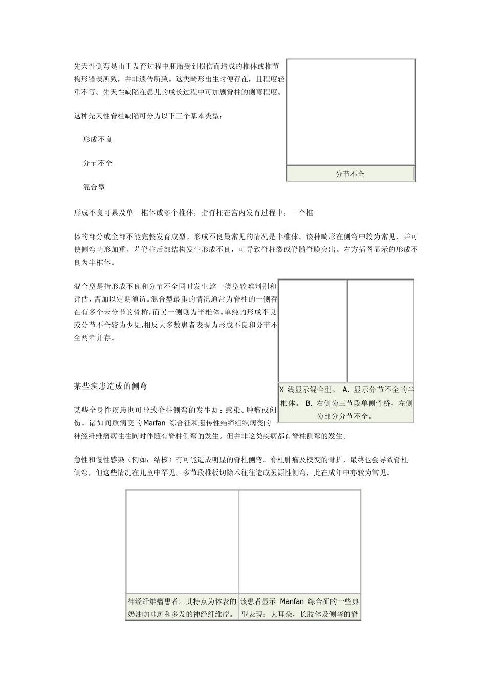 脊柱生物力学基本知识_第3页