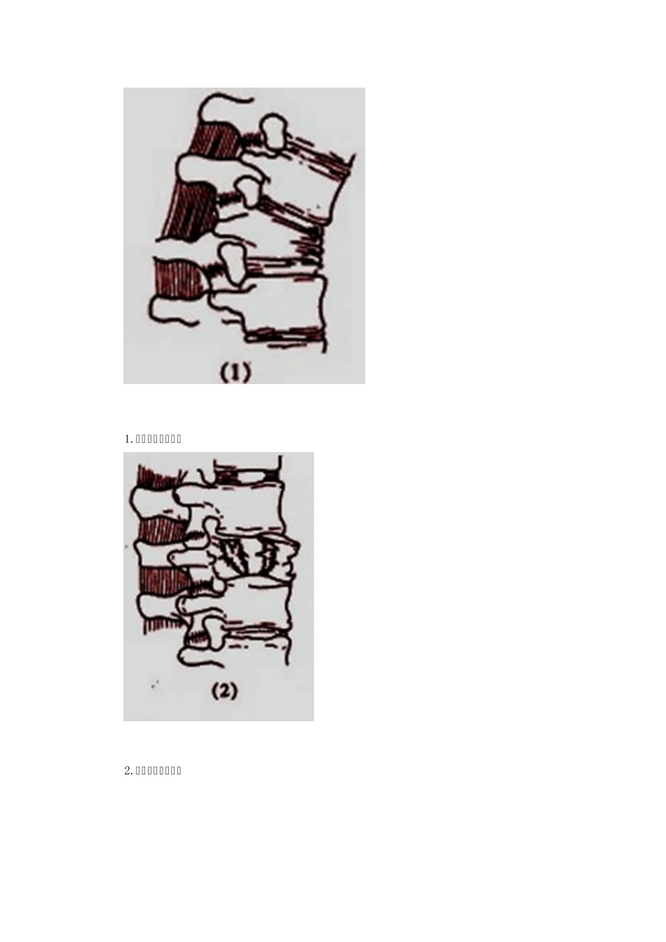 脊柱脊髓损伤和骨盆骨折_第3页